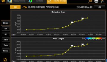 MYAH - Refractive Error and Axial Length Trend Graph