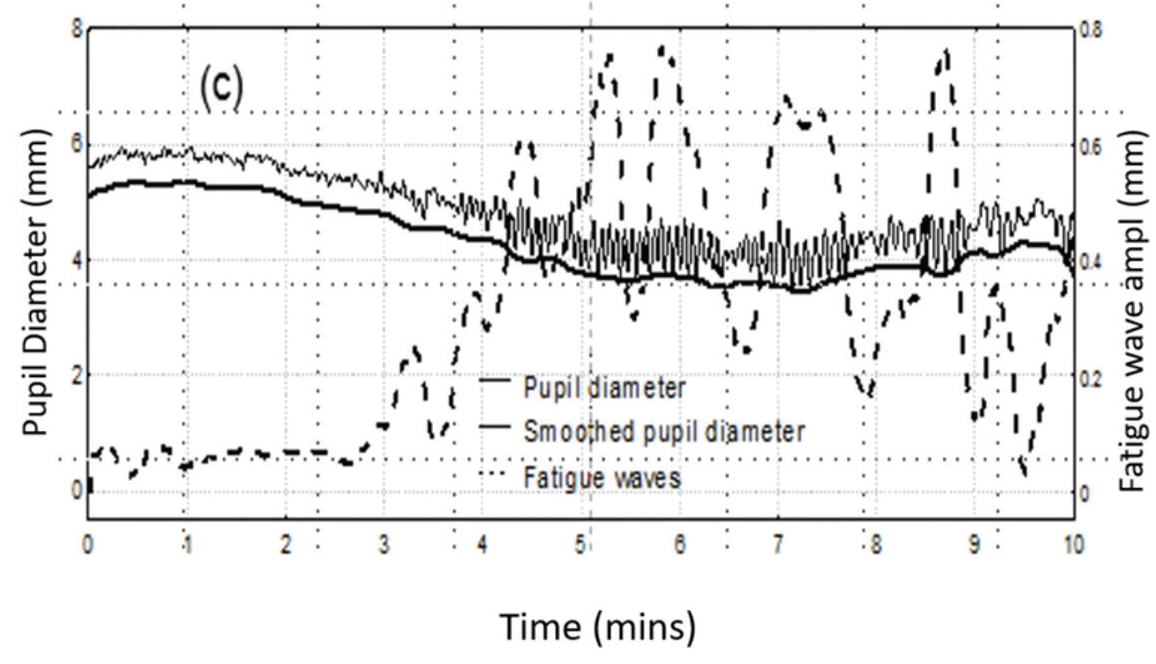 topcon-fig-1_1612290978.png