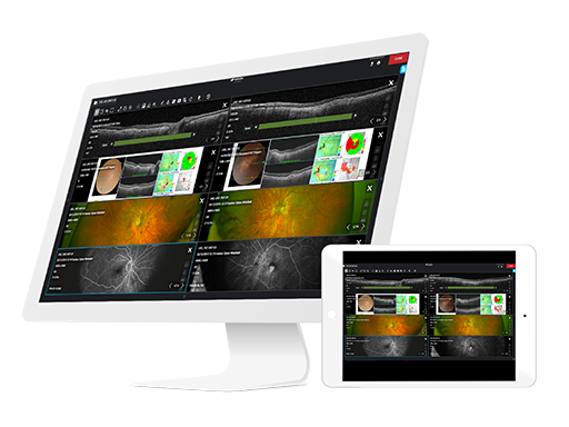 Topcon Harmony patient results